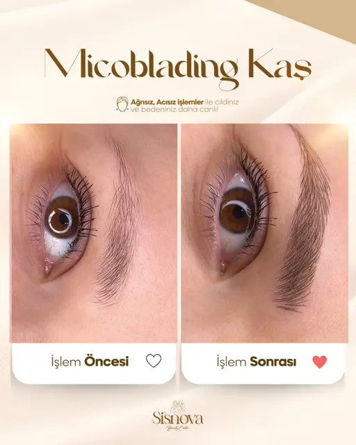 Microblading Kaş – Öncesi ve Sonrası