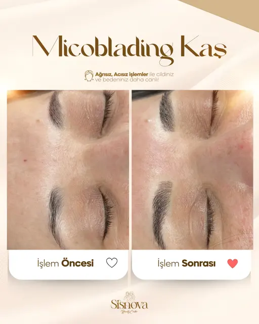 Microblading Kaş – Öncesi ve Sonrası